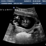E 16w3d girl