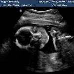 E 24w6d