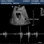 E 6w3d heartbeat